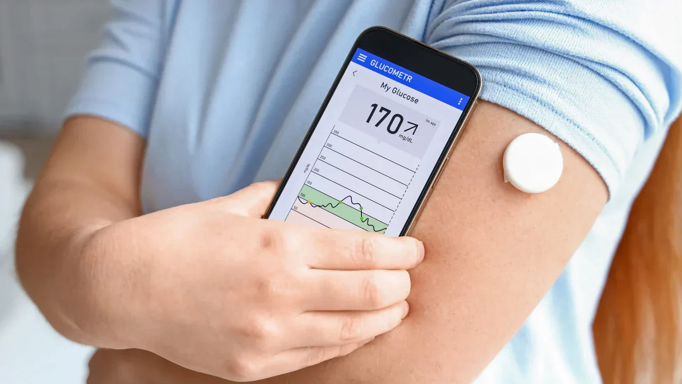 15 Ημέρες με CGM Παρακολούθηση Επιπέδων Γλυκόζης: 5 Συμπεράσματα Διατροφολόγου για τη Γλυκόζη